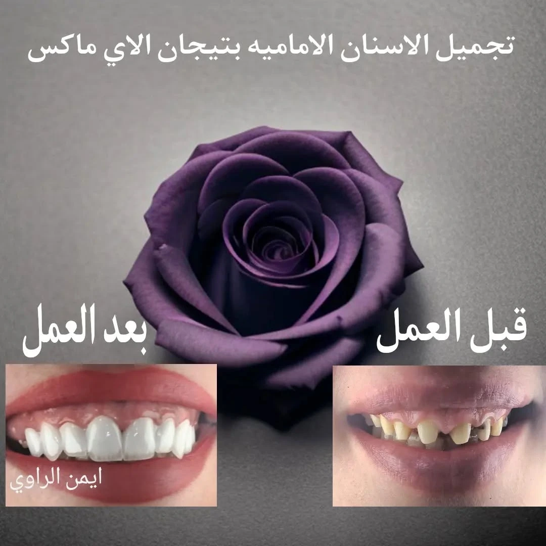 صورة قبل العمل من منشور الدكتور الأصلي